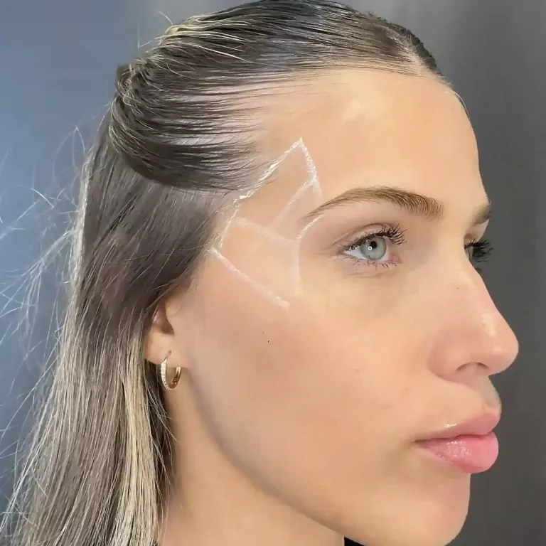 Fosa-temporal_32_11zon