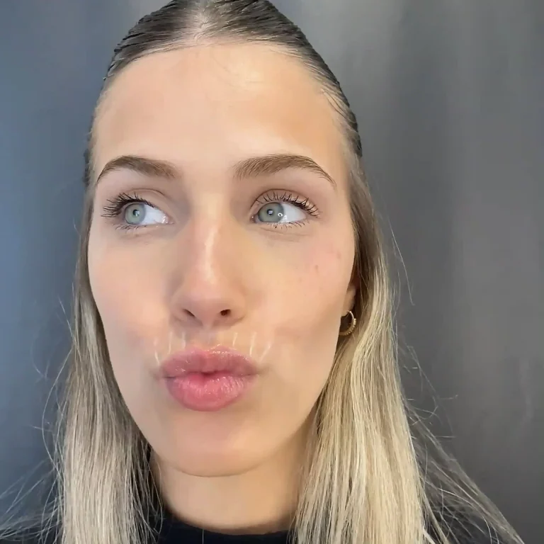 arr-peribucales_30_11zon